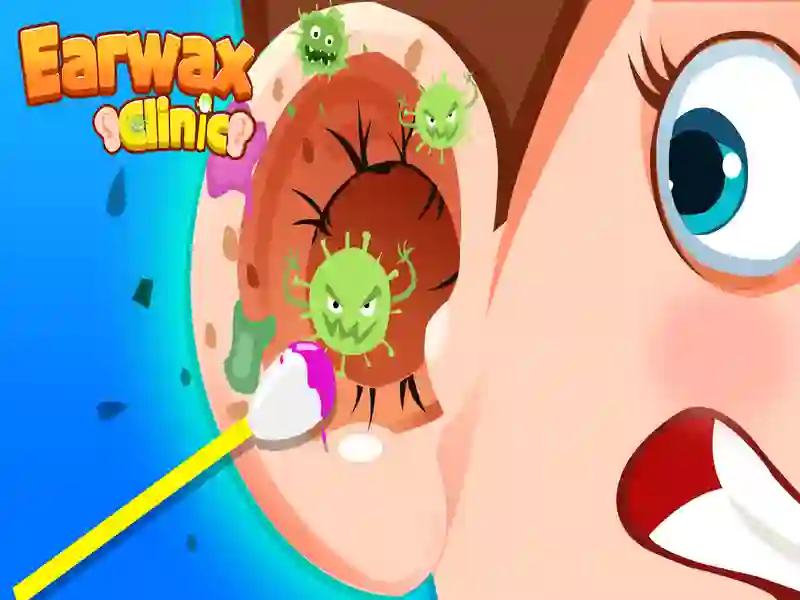 คลินิก Earwax เกมออนไลน์